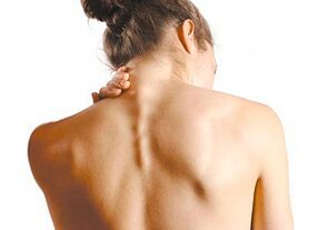 How does cervical osteochondrosis manifest