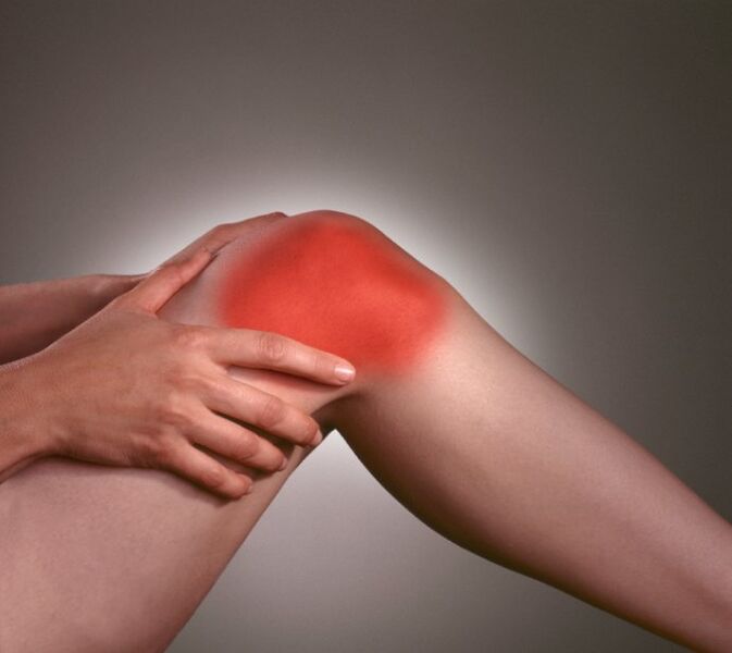 Inflammation in the joint of the knee with arthrosis